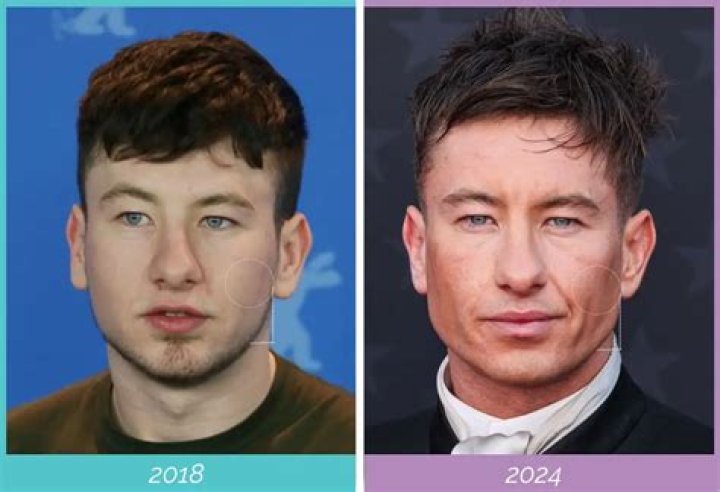 Barry Keoghan's Unforgettable Eyes: A Captivating Gaze That Enchants