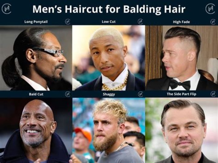 Celebrating Baldness: A Visual Tribute To Bald People