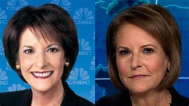 Gloria Borger's Plastic Surgery Transformation: The Truth Revealed