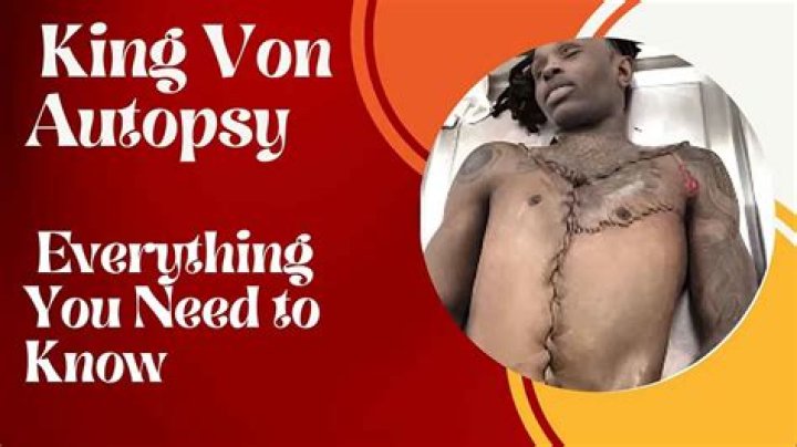 The Shocking Truth: Leaked Autopsy Reveals Secrets Of King Von