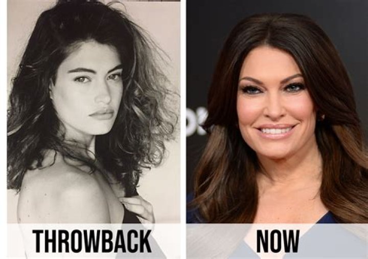 Unveiling The Allure Of Kimberly Guilfoyle's Lip Aesthetic