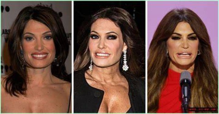 Unveiling The Kim Guilfoyle Transformation: A Journey Of Change