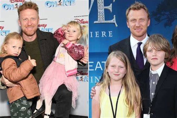 Unveiling The Talents Of Kevin McKidd: A Journey Through His Life And Career