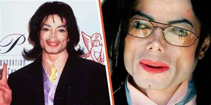 Unveiling The Truth: Michael Jackson's Autopsy